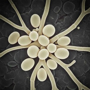 Šta je Kandida (Candida albicans)?